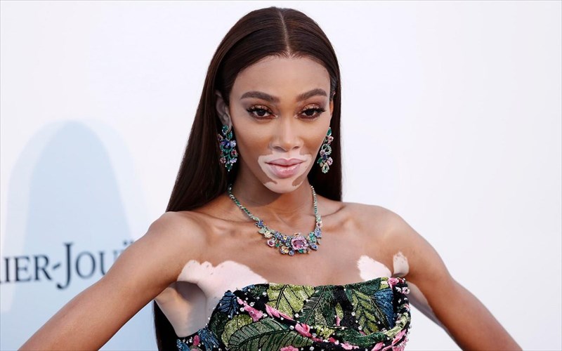 pos-diaxeirizetai-tin-eksogiini-omorfia-tis-i-winnie-harlow-winnie-harlow