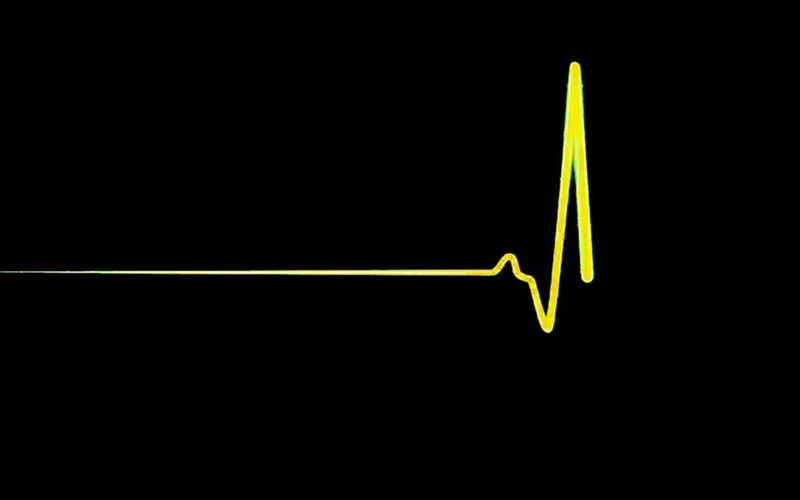 support-art-workers-i-parembasi-gia-koufontina-kai-gia-analipsi-politikon-euthunon-oson-sumbainoun-sti-xora