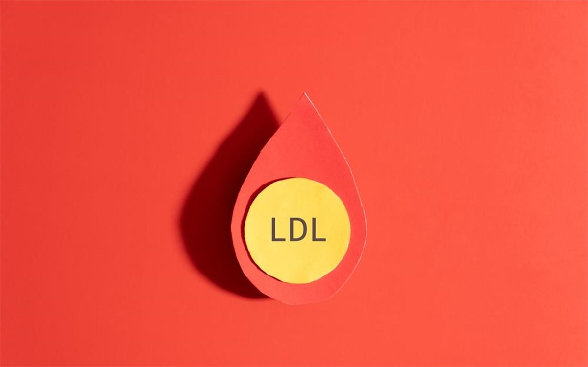 ldl-xolisteroli