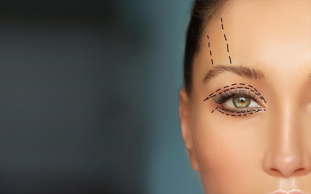 blefaroplastiki