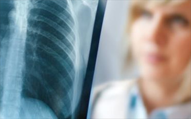 pos-mporoume-na-dunamosoume-ta-osta-mas-kai-na-apofugoume-tin-osteoporosi