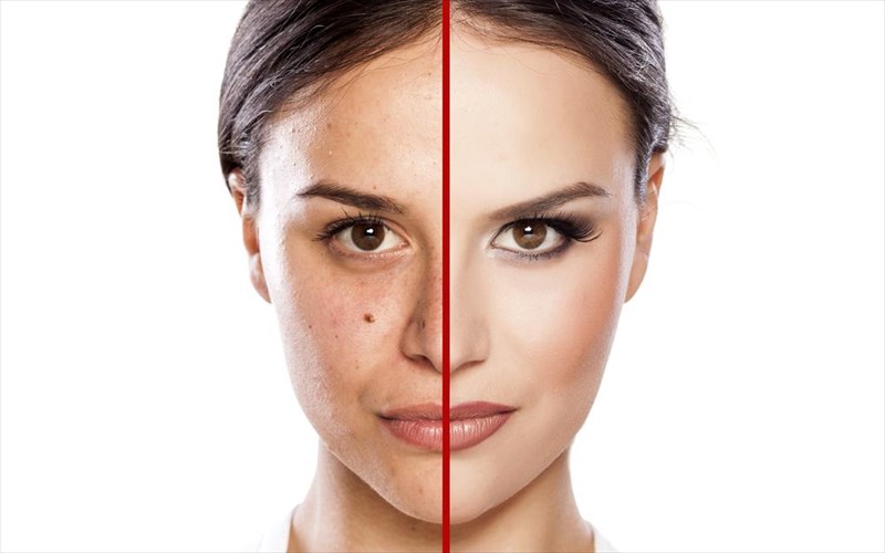 antigirantikes-kremes-pote-blepoume-ta-apotelesmata