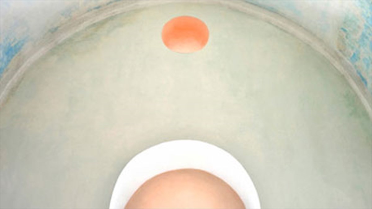 ti-krubetai-pera-apo-to-leuko